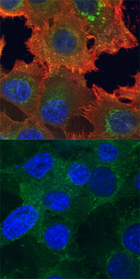 <b>Biological Strategies Validation. </b>Axl phosphorylated at Y779 and total Axl were assessed in immersion fixed A172 human glioblastoma cells incubated with (upper panel) or without (lower panel) the phosphatase inhibitor pervanadate at 100 µM for 5 minutes. Phospho-Axl was detected using Mouse Anti-Human Phospho-Axl (Y779) Monoclonal Antibody (Catalog # MAB6965) at 10 µg/mL for 3 hours at room temperature. Cells were stained using the NorthernLights™ 557-conjugated Anti-Mouse IgG Secondary Antibody (red; Catalog # NL007) and counterstained using DAPI (blue). Total Axl was detected using Goat Anti-Human Axl Antigen Affinity-purified Polyclonal Antibody (Catalog # AF154). Cells were stained using the NorthernLights™ 493-conjugated Anti-Goat IgG Secondary Antibody (green; Catalog # NL003). Specific staining was localized to cytoplasm and cell surfaces. View our protocol for Fluorescent ICC Staining of Cells on Coverslips.