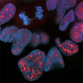 Bcl-xL/Bcl-2 Associated Death Promoter phosphorylated at S99 (Phospho-Bad (S99)) was detected in immersion fixed HEK293 human embryonic kidney cell line using Mouse Anti-Human Phospho-Bad (S99) Monoclonal Antibody (Catalog # MAB7764) at 25 µg/mL for 3 hours at room temperature. Cells were stained using the NorthernLights™ 557-conjugated Anti-Mouse IgG Secondary Antibody (red; Catalog # NL007) and counterstained with DAPI (blue). Specific staining was localized to nuclei. Note that labeling is absent in dividing cells. View our protocol for Fluorescent ICC Staining of Cells on Coverslips.