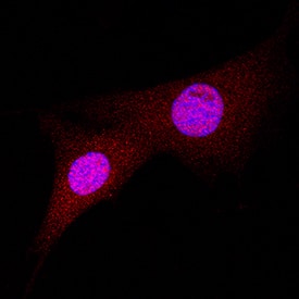 Immunocytochemistry Bax Antibody [Unconjugated]