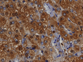 Bax was detected in immersion fixed paraffin-embedded sections of human liver using 10 µg/mL Rabbit Anti-Human/Mouse Bax Antigen Affinity-purified Polyclonal Antibody (Catalog # AF820) overnight at 4 °C. Tissue was stained with the Anti-Rabbit HRP-DAB Cell & Tissue Staining Kit (brown; Catalog # CTS005) and counterstained with hematoxylin (blue). View our protocol for Chromogenic IHC Staining of Paraffin-embedded Tissue Sections.