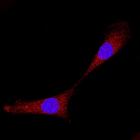 Bax was detected in immersion fixed A549 human lung carcinoma cell line using Mouse Anti-Human Bax Minus C-Terminus Monoclonal Antibody (Catalog # MAB846) at 8 µg/mL for 3 hours at room temperature. Cells were stained using the NorthernLights™ 557-conjugated Anti-Mouse IgG Secondary Antibody (red; Catalog # NL007) and counterstained with DAPI (blue). Specific staining was localized to cytoplasm. View our protocol for Fluorescent ICC Staining of Cells on Coverslips.