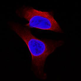 Bax was detected in immersion fixed A549 human lung carcinoma cell line using Mouse Anti-Human/Mouse Bax Minus C-Terminus Monoclonal Antibody (Catalog # MAB883) at 8 µg/mL for 3 hours at room temperature. Cells were stained using the NorthernLights™ 557-conjugated Anti-Mouse IgG Secondary Antibody (red; NL007) and counterstained with DAPI (blue). Specific staining was localized to cytoplasm. View our protocol for Fluorescent ICC Staining of Cells on Coverslips.