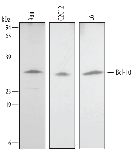 Western blot shows lysates of Raji human Burkitt's lymphoma cell line, C2C12 mouse myoblast cell line, and L6 rat myoblast cell line. PVDF membrane was probed with 1 µg/mL of Human/Mouse/Rat Bcl-10 Monoclonal Antibody (Catalog # MAB2889) followed by HRP-conjugated Anti-Mouse IgG Secondary Antibody (Catalog # HAF007). A specific band was detected for Bcl-10 at approximately 26 kDa (as indicated). This experiment was conducted under reducing conditions and using Immunoblot Buffer Group 2.