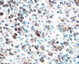Immunohistochemistry BCL-W/BCL2L2 Antibody