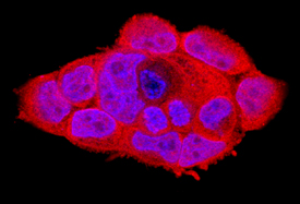 Bcl-10 was detected in immersion fixed A431 human epithelial carcinoma cell line using Goat Anti-Human Bcl-10 Antigen Affinity-purified Polyclonal Antibody (Catalog # AF2889) at 10 µg/mL for 3 hours at room temperature. Cells were stained using the NorthernLights™ 557-conjugated Anti-Goat IgG Secondary Antibody (red; Catalog # NL001) and counterstained with DAPI (blue). Specific staining was localized to cytoplasm. View our protocol for Fluorescent ICC Staining of Cells on Coverslips.