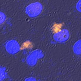 Beclin 1 was detected in immersion fixed HeLa human cervical epithelial carcinoma cell line using Sheep Anti-Human/Mouse Beclin 1 Antigen Affinity-purified Polyclonal Antibody (Catalog # AF5295) at 15 µg/mL for 3 hours at room temperature. Cells were stained using the NorthernLights™ 557-conjugated Anti-Sheep IgG Secondary Antibody (yellow; Catalog # NL010) and counterstained with DAPI (blue). Specific staining was localized to autophagosomes. View our protocol for Fluorescent ICC Staining of Cells on Coverslips.