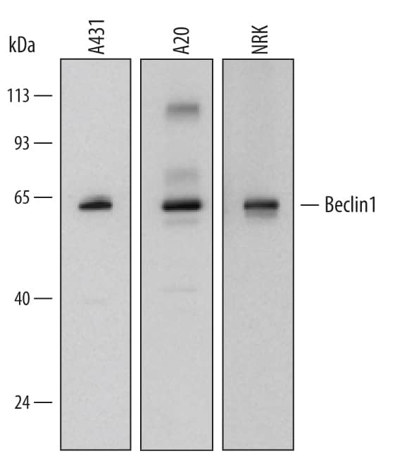 Western blot shows lysates of A431 human epithelial carcinoma cell line, A20 mouse B cell lymphoma cell line, and NRK rat normal kidney cell line. PVDF Membrane was probed with 0.1 µg/mL of Mouse Anti-Human Beclin 1 Monoclonal Antibody (Catalog # MAB5295) followed by HRP-conjugated Anti-Mouse IgG Secondary Antibody (HAF007). A specific band was detected for Beclin 1 at approximately 60 kDa (as indicated). This experiment was conducted under reducing conditions and using Immunoblot Buffer Group 2.