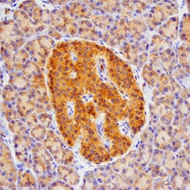 Betacellulin/BTC was detected in immersion fixed paraffin-embedded sections of human pancreas using Goat Anti-Human Betacellulin/BTC Antigen Affinity-purified Polyclonal Antibody (Catalog # AF-261-NA) at 15 µg/mL overnight at 4 °C. Tissue was stained using the Anti-Goat HRP-DAB Cell & Tissue Staining Kit (brown; CTS008) and counterstained with hematoxylin (blue). Specific staining was localized to islets. View our protocol for Chromogenic IHC Staining of Paraffin-embedded Tissue Sections.