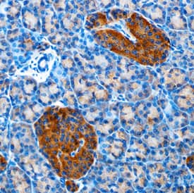Betacellulin/BTC was detected in formalin fixed paraffin-embedded sections of human pancreas using Mouse Anti-Human Betacellulin/BTC Monoclonal Antibody (Catalog # MAB2611) at 1.7 µg/mL overnight at 4 °C. Tissue was stained using the Anti-Mouse HRP-DAB Cell & Tissue Staining Kit (brown; Catalog # CTS002) and counter-stained with hematoxylin (blue). Specific staining was localized to cells of the Islet of Langerhans. View our protocol for Chromogenic IHC Staining of Paraffin-embedded Tissue Sections.