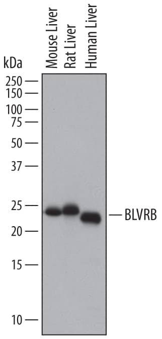Western blot shows lysates of human liver tissue, mouse liver tissue, and rat liver tissue. PVDF membrane was probed with 1 µg/mL of Sheep Anti-Human Biliverdin Reductase B/BLVRB Antigen Affinity-purified Polyclonal Antibody (Catalog # AF6568) followed by HRP-conjugated Anti-Sheep IgG Secondary Antibody (Catalog # HAF016). A specific band was detected for Biliverdin Reductase B/BLVRB at approximately 22 kDa (as indicated). This experiment was conducted under reducing conditions and using Immunoblot Buffer Group 1.