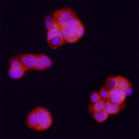 Bora was detected in immersion fixed MCF-7 human breast cancer cell line using Goat Anti-Human Bora Antigen Affinity-purified Polyclonal Antibody (Catalog # AF6856) at 15 µg/mL for 3 hours at room temperature. Cells were stained using the NorthernLights™ 557-conjugated Anti-Goat IgG Secondary Antibody (red; Catalog # NL001) and counterstained with DAPI (blue). Specific staining was localized to cytoplasm. View our protocol for Fluorescent ICC Staining of Cells on Coverslips.