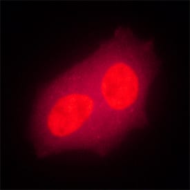 Bora was detected in immersion fixed MCF-7 human breast cancer cell line using Mouse Anti-Human Bora Monoclonal Antibody (Catalog # MAB6856) at 25 µg/mL for 3 hours at room temperature. Cells were stained using the NorthernLights™ 557-conjugated Anti-Mouse IgG Secondary Antibody (red; Catalog # NL007). Specific staining was localized to nuclei. View our protocol for Fluorescent ICC Staining of Cells on Coverslips.