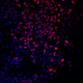 Brachyury was detected in immersion fixed BG01V human embryonic stem cells differentiated into mesoderm using Goat Anti-Human Brachyury Antigen Affinity-purified Polyclonal Antibody (Catalog # AF2085) at 10 µg/mL for 3 hours at room temperature. Cells were stained using the Northern-Lights™ 557-conjugated Anti-Goat IgG Secondary Antibody (red; NL001) and counter-stained with DAPI (blue). Specific staining was localized to nuclei. View our protocol for Fluorescent ICC Staining of Cells on Coverslips.