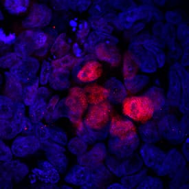 Brachyury was detected in immersion fixed BG01V human embryonic stem cells differentiated into mesoderm using Rabbit Anti-Human Brachyury Monoclonal Antibody (Catalog # MAB20851) at a 10 µg/mL for 3 hours at room temperature. Cells were stained using the NorthernLights™ 557-conjugated Anti-Rabbit IgG Secondary Antibody (red; Catalog # NL004) and counterstained with DAPI (blue). Specific staining was localized to nuclei. View our protocol for Fluorescent ICC Staining of Stem Cells on Coverslips.