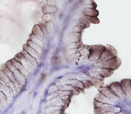 Immunohistochemistry Bradykinin RB2/BDKRB2 Antibody (471916) [Unconjugated]