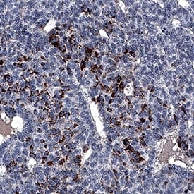 Immunohistochemistry Bradykinin RB2/BDKRB2 Antibody (471902) [Unconjugated]