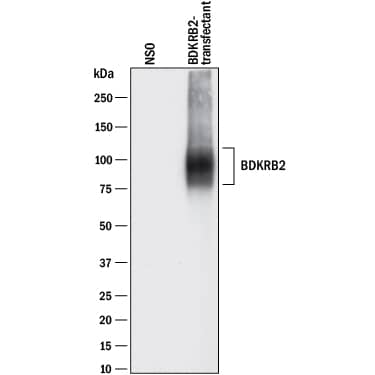Western Blot Bradykinin RB2/BDKRB2 Antibody (471902) [Unconjugated]