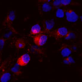 Immunocytochemistry Brevican Antibody [Unconjugated]