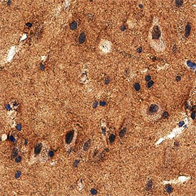 Immunohistochemistry Brevican Antibody [Unconjugated]