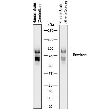 Western blot shows lysates of human brain (cerebellum) tissue and human brain (motor cortex) tissue. PVDF membrane was probed with 0.1 µg/mL of Sheep Anti-Human/Rat Brevican Antigen Affinity-purified Polyclonal Antibody (Catalog # AF4009) followed by Donkey Anti-Sheep IgG HRP-conjugated Antigen Affinity-purified Polyclonal Antibody(Catalog # HAF016) . Specific bands were detected for Brevican at approximately 60 and 90 kDa (as indicated). This experiment was conducted under reducing conditions and using Immunoblot Buffer Group 1.