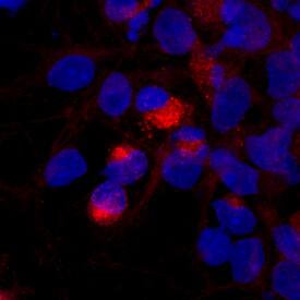 Brevican was detected in immersion fixed rat cortical stem cells differentiated for 7 days by growth factor withdrawal using Sheep Anti-Human Brevican Biotinylated Antigen Affinity-purified Polyclonal Antibody (Catalog # BAF4009) at 10 µg/mL for 3 hours at room temperature. Cells were stained using the NorthernLights™ 557-conjugated Streptavidin (red; Catalog # NL999) and counterstained with DAPI (blue). Specific staining was localized to cytoplasm. View our protocol for Fluorescent ICC Staining of Stem Cells on Coverslips.