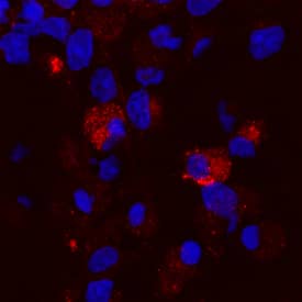 Brevican was detected in immersion fixed rat cortical stem cells differentiated by growth factor withdrawal using Mouse Anti-Human Brevican Monoclonal Antibody (Catalog # MAB40091) at 10 µg/mL for 3 hours at room temperature. Cells were stained using the NorthernLights™ 557-conjugated Anti-Mouse IgG Secondary Antibody (red; Catalog # NL007) and counterstained with DAPI (blue). Specific staining was localized to cytoplasm. View our protocol for Fluorescent ICC Staining of Stem Cells on Coverslips.