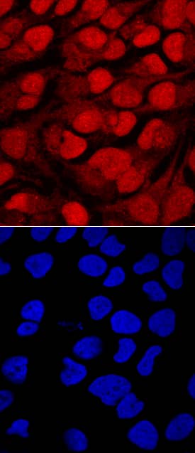 Brg1 was detected in immersion fixed HeLa human cervical epithelial carcinoma cell line using Goat Anti-Human Brg1 Antigen Affinity-purified Polyclonal Antibody (Catalog # AF5738) at 10 µg/mL for 3 hours at room temperature. Cells were stained using the NorthernLights™ 557-conjugated Anti-Goat IgG Secondary Antibody (red, upper panel; Catalog # NL001) and counterstained with DAPI (blue, lower panel). Specific staining was localized to nuclei. View our protocol for Fluorescent ICC Staining of Cells on Coverslips.