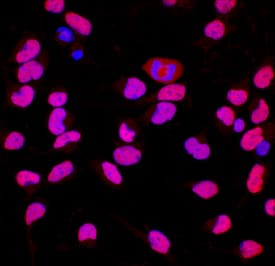 Immunocytochemistry Brg1 Antibody [Unconjugated]