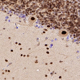 Brg1 was detected in immersion fixed paraffin-embedded sections of human brain (cerebellum) using Rabbit Anti-Human Brg1 Monoclonal Antibody (Catalog # MAB5738) at 1 µg/mL for 1 hour at room temperature followed by incubation with the Anti-Rabbit IgG VisUCyte™ HRP Polymer Antibody (Catalog # VC003). Tissue was stained using DAB (brown) and counterstained with hematoxylin (blue). Specific staining was localized to neuronal nuclei. View our protocol for IHC Staining with VisUCyte HRP Polymer Detection Reagents.