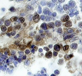 Immunohistochemistry Brk Antibody