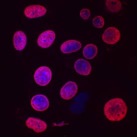 Bromodeoxyuridine/BrdU was detected in immersion fixed MCF-7 human breast cancer cell line stimulated with BrdU using Mouse Anti-Bromodeoxyuridine/ BrdU Antigen Affinity-purified Monoclonal Antibody (Catalog # MAB7225) at 10 µg/mL for 3 hours at room temperature. Cells were stained using the NorthernLights™ 557-conjugated Anti-Mouse IgG Secondary Antibody (red; Catalog # NL007) and counterstained with DAPI (blue). Specific staining was localized to nuclei. View our protocol for Fluorescent ICC Staining of Cells on Coverslips.