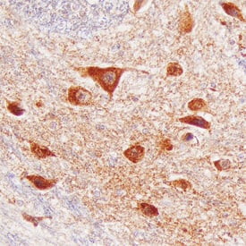 Brorin/VWC2 was detected in immersion fixed paraffin-embedded sections of human brain (medulla) using Sheep Anti-Human Brorin/VWC2 Antigen Affinity-purified Polyclonal Antibody (Catalog # AF6147) at 10 µg/mL overnight at 4 °C. Before incubation with the primary antibody, tissue was subjected to heat-induced epitope retrieval using Antigen Retrieval Reagent-Basic (Catalog # CTS013). Tissue was stained using the Anti-Sheep HRP-DAB Cell & Tissue Staining Kit (brown; Catalog # CTS019) and counterstained with hematoxylin (blue). Specific staining was localized to neurons. View our protocol for Chromogenic IHC Staining of Paraffin-embedded Tissue Sections.