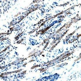 Brorin/VWC2 was detected in immersion fixed frozen sections of mouse embryo (13 d.p.c.) using Sheep Anti-Mouse Brorin/VWC2 Antigen Affinity-purified Polyclonal Antibody (Catalog # AF6730) at 5 µg/mL overnight at 4 °C. Tissue was stained using the Anti-Sheep HRP-DAB Cell & Tissue Staining Kit (brown; Catalog # CTS019) and counterstained with hematoxylin (blue). Specific staining was localized to the cytoplasm of mesenchyme/muscle cells. View our protocol for Chromogenic IHC Staining of Frozen Tissue Sections.