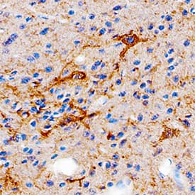 Immunohistochemistry Butyrylcholinesterase/BCHE Antibody [Unconjugated]