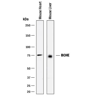 Western Blot Butyrylcholinesterase/BCHE Antibody [Unconjugated]