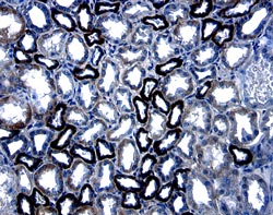 Immunohistochemistry C-Reactive Protein/CRP Antibody [Unconjugated]