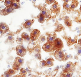 Immunohistochemistry C-Reactive Protein/CRP Antibody [Unconjugated]