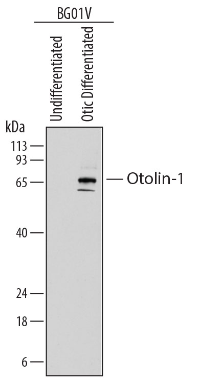 Western Blot Otolin-1 Antibody (839418) [Unconjugated]