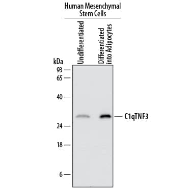 Western blot shows lysates of human mesenchymal stem cells either undifferentiated or differentiated into adipocytes. PVDF membrane was probed with 1 µg/mL of Sheep Anti-Human CTRP3/C1qTNF3/CORS26 Antigen Affinity-purified Polyclonal Antibody (Catalog # AF7925) followed by HRP-conjugated Anti-Sheep IgG Secondary Antibody (Catalog # HAF016). A specific band was detected for CTRP3/C1qTNF3/CORS26 at approximately 28 kDa (as indicated). This experiment was conducted under reducing conditions and using Immunoblot Buffer Group 1.