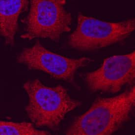 Immunocytochemistry C2CD3 Antibody