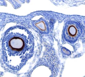 Immunohistochemistry C4.4A/LYPD3 Antibody