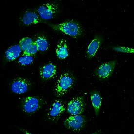 Calcium Activated Nucleotidase 1/CANT1 was detected in immersion fixed PC-3 human prostate cancer cell line using Sheep Anti-Human Calcium Activated Nucleotidase 1/ CANT1 Antigen Affinity-purified Polyclonal Antibody (Catalog # AF6720) at 10 µg/mL for 3 hours at room temperature. Cells were stained using the NorthernLights™ 637-conjugated Anti-Sheep IgG Secondary Antibody (green; Catalog # NL011) and counterstained with DAPI (blue). Specific staining was localized to perinuclei. View our protocol for Fluorescent ICC Staining of Cells on Coverslips.