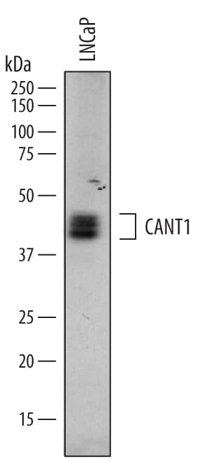 Western blot shows lysates of LNCaP human prostate cancer cell line. PVDF membrane was probed with 0.2 µg/mL of Sheep Anti-Human Calcium Activated Nucleotidase 1/CANT1 Antigen Affinity-purified Polyclonal Antibody (Catalog # AF6720) followed by HRP-conjugated Anti-Sheep IgG Secondary Antibody (Catalog # HAF016). A specific band was detected for Calcium Activated Nucleotidase 1/CANT1 at approximately 40-45 kDa (as indicated). This experiment was conducted under reducing conditions and using Immunoblot Buffer Group 1.