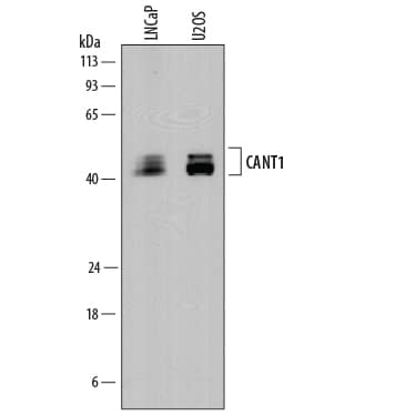 Western Blot Calcium Activated Nucleotidase 1/CANT1 Antibody (861206) [Unconjugated]