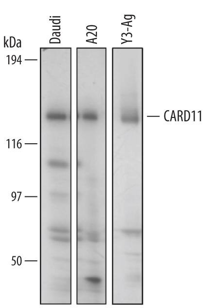 Western blot shows lysates of Daudi human Burkitt's lymphoma cell line, A20 mouse B cell lymphoma cell line, and Y3-Ag rat myeloid cell line. PVDF membrane was probed with 1 µg/mL of Human/Mouse/Rat CARD11/CARMA1 Antigen Affinity-purified Polyclonal Antibody (Catalog # AF4839) followed by HRP-conjugated Anti-Goat IgG Secondary Antibody (Catalog # HAF109). A specific band was detected for CARD11/CARMA1 at approximately 133 kDa (as indicated). This experiment was conducted under reducing conditions and using Immunoblot Buffer Group 2.