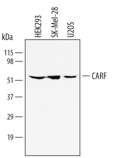 Western blot shows lysates of HEK293 human embryonic kidney cell line, SK-Mel-28 human malignant melanoma cell line, and U2OS human osteosarcoma cell line. PVDF membrane was probed with 1 µg/mL of Human CARF Antigen Affinity-purified Polyclonal Antibody (Catalog # AF4195) followed by HRP-conjugated Anti-Goat IgG Secondary Antibody (Catalog # HAF017). A specific band was detected for CARF at approximately 61 kDa (as indicated). This experiment was conducted using Immunoblot Buffer Group 1.