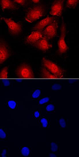 CBFB was detected in immersion fixed HUVEC human umbilical vein endothelial cells using Sheep Anti-Human/Mouse CBFB Antigen Affinity-purified Polyclonal Antibody (Catalog # AF7349) at 10 µg/mL for 3 hours at room temperature. Cells were stained using the NorthernLights™ 557-conjugated Anti-Sheep IgG Secondary Antibody (red, upper panel; Catalog # NL010) and counterstained with DAPI (blue, lower panel). Specific staining was localized to cytoplasm and nuclei. View our protocol for Fluorescent ICC Staining of Cells on Coverslips.