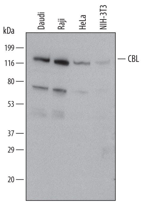 Western blot shows lysates of Daudi human Burkitt's lymphoma cell line, Raji human Burkitt's lymphoma cell line, HeLa human cervical epithelial carcinoma cell line, and NIH-3T3 mouse embryonic fibroblast cell line. PVDF Membrane was probed with 0.5 µg/mL of Mouse Anti-Human/Mouse CBL Monoclonal Antibody (Catalog # MAB5998) followed by HRP-conjugated Anti-Mouse IgG Secondary Antibody (HAF007). A specific band was detected for CBL at approximately 120 kDa (as indicated). This experiment was conducted under reducing conditions and using Immunoblot Buffer Group 1.