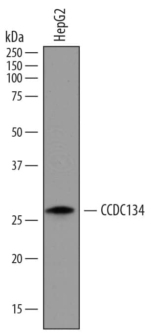 Western Blot CCDC134 Antibody (814208)