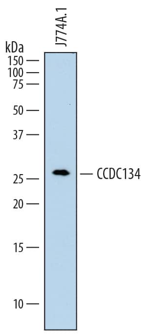 Western blot shows lysates of J774A.1 mouse reticulum cell sarcoma macrophage cell line. PVDF membrane was probed with 2 µg/mL of Rat Anti-Mouse CCDC134 Monoclonal Antibody (Catalog # MAB7786) followed by HRP-conjugated Anti-Rat IgG Secondary Antibody (Catalog # HAF005). A specific band was detected for CCDC134 at approximately 30 kDa (as indicated). This experiment was conducted under reducing conditions and using Immunoblot Buffer Group 1.
